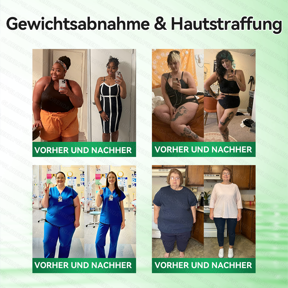 🇦🇹𝐎𝐟𝐟𝐢𝐳𝐢𝐞𝐥𝐥𝐞𝐫 𝐒𝐡𝐨𝐩 | 👩‍⚕️💃 𝑮𝑳𝑶𝐑𝐄𝐍𝐃𝘼®𝙈𝙤𝙧𝙞𝙣𝗴𝗮 · 𝗕𝗲𝗿𝗯𝗲𝗿𝒊𝒏 × 𝑵𝘼𝘿+ 10-𝙞𝙣-𝟏 𝐀𝐝𝐯𝐚𝗻𝗰𝗲𝗱 𝗡𝗮𝙣𝙤 𝙈𝙞𝙠𝙧𝐨𝐧𝐚𝐝𝐞𝐥-𝐏𝐚𝒕𝒄𝗵(𝐍𝐮𝐫 𝐞𝐢𝐧𝐦𝐚𝐥 𝐭ä𝐠𝐥𝐢𝐜𝐡, 𝐬𝐢𝐜𝐡𝐭𝐛𝐚𝐫𝐞 𝐕𝐞𝐫ä𝐧𝐝𝐞𝐫𝐮𝐧𝐠𝐞𝐧 𝐢𝐧 𝟕 𝐓𝐚𝐠𝐞𝐧)✅ 𝐅ü𝐫 𝐅𝐞𝐭𝐭𝐥𝐞𝐢𝐛𝐢𝐠𝐤𝐞𝐢𝐭, 𝐇𝐚𝐮𝐭𝐬𝐭𝐫𝐚𝐟𝐟𝐮𝐧𝐠, 𝐃𝐢𝐚𝐛𝐞𝐭𝐞𝐬, 𝐒𝐜𝐡𝐥𝐚𝐟𝐚𝐩𝐧𝐨𝐞, 𝐆𝐞𝐥𝐞𝐧𝐤𝐩𝐫𝐨𝐛𝐥𝐞𝐦𝐞 𝐮𝐧𝐝 𝐦𝐞𝐡𝐫!