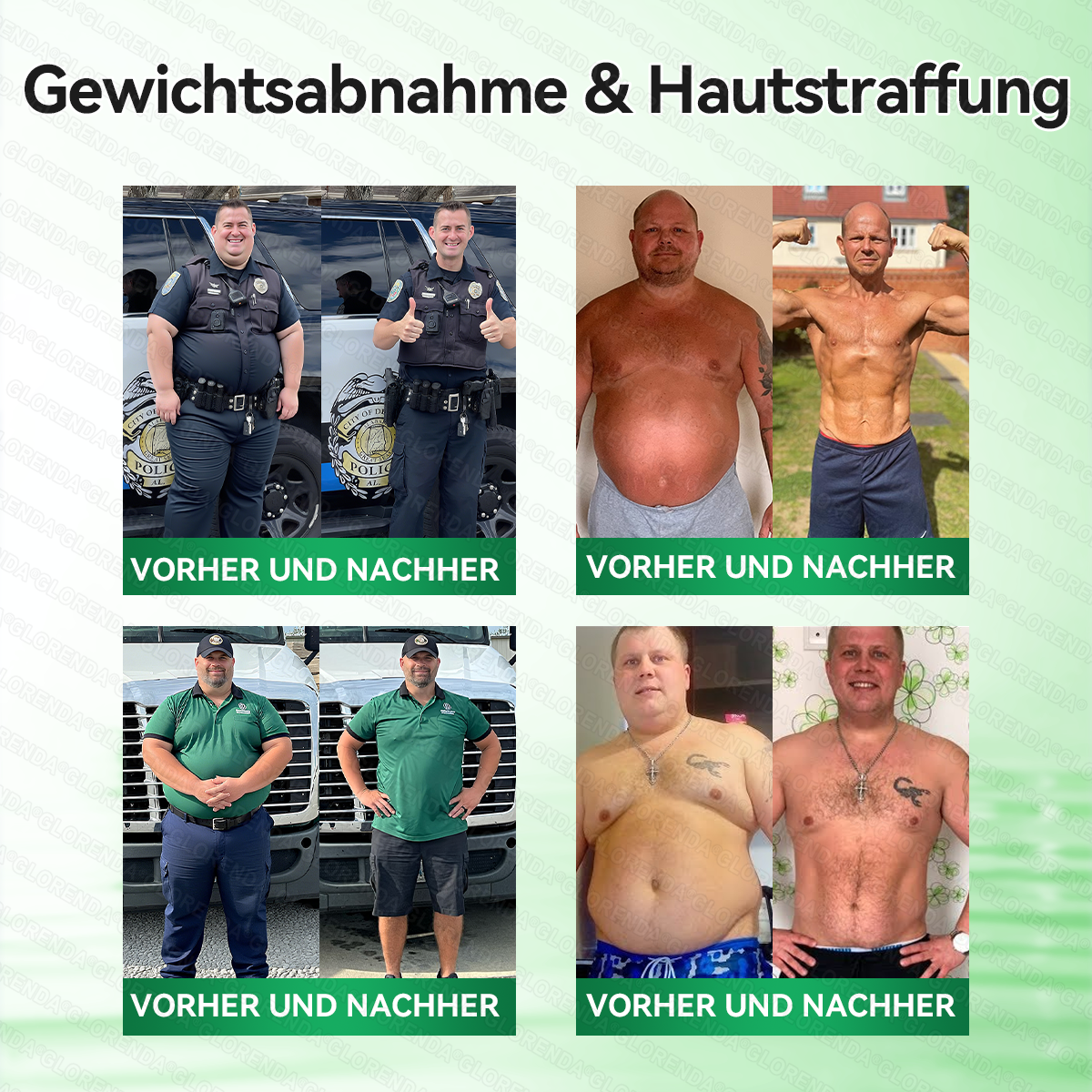🇦🇹𝐎𝐟𝐟𝐢𝐳𝐢𝐞𝐥𝐥𝐞𝐫 𝐒𝐡𝐨𝐩 | 👩‍⚕️💃 𝑮𝑳𝑶𝐑𝐄𝐍𝐃𝘼®𝙈𝙤𝙧𝙞𝙣𝗴𝗮 · 𝗕𝗲𝗿𝗯𝗲𝗿𝒊𝒏 × 𝑵𝘼𝘿+ 10-𝙞𝙣-𝟏 𝐀𝐝𝐯𝐚𝗻𝗰𝗲𝗱 𝗡𝗮𝙣𝙤 𝙈𝙞𝙠𝙧𝐨𝐧𝐚𝐝𝐞𝐥-𝐏𝐚𝒕𝒄𝗵(𝐍𝐮𝐫 𝐞𝐢𝐧𝐦𝐚𝐥 𝐭ä𝐠𝐥𝐢𝐜𝐡, 𝐬𝐢𝐜𝐡𝐭𝐛𝐚𝐫𝐞 𝐕𝐞𝐫ä𝐧𝐝𝐞𝐫𝐮𝐧𝐠𝐞𝐧 𝐢𝐧 𝟕 𝐓𝐚𝐠𝐞𝐧)✅ 𝐅ü𝐫 𝐅𝐞𝐭𝐭𝐥𝐞𝐢𝐛𝐢𝐠𝐤𝐞𝐢𝐭, 𝐇𝐚𝐮𝐭𝐬𝐭𝐫𝐚𝐟𝐟𝐮𝐧𝐠, 𝐃𝐢𝐚𝐛𝐞𝐭𝐞𝐬, 𝐒𝐜𝐡𝐥𝐚𝐟𝐚𝐩𝐧𝐨𝐞, 𝐆𝐞𝐥𝐞𝐧𝐤𝐩𝐫𝐨𝐛𝐥𝐞𝐦𝐞 𝐮𝐧𝐝 𝐦𝐞𝐡𝐫!