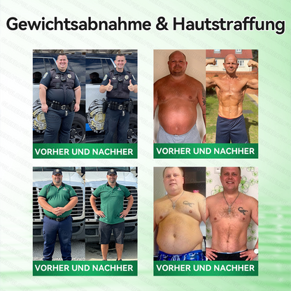 🇦🇹𝐎𝐟𝐟𝐢𝐳𝐢𝐞𝐥𝐥𝐞𝐫 𝐒𝐡𝐨𝐩 | 👩‍⚕️💃 𝑮𝑳𝑶𝐑𝐄𝐍𝐃𝘼®𝙈𝙤𝙧𝙞𝙣𝗴𝗮 · 𝗕𝗲𝗿𝗯𝗲𝗿𝒊𝒏 × 𝑵𝘼𝘿+ 10-𝙞𝙣-𝟏 𝐀𝐝𝐯𝐚𝗻𝗰𝗲𝗱 𝗡𝗮𝙣𝙤 𝙈𝙞𝙠𝙧𝐨𝐧𝐚𝐝𝐞𝐥-𝐏𝐚𝒕𝒄𝗵(𝐍𝐮𝐫 𝐞𝐢𝐧𝐦𝐚𝐥 𝐭ä𝐠𝐥𝐢𝐜𝐡, 𝐬𝐢𝐜𝐡𝐭𝐛𝐚𝐫𝐞 𝐕𝐞𝐫ä𝐧𝐝𝐞𝐫𝐮𝐧𝐠𝐞𝐧 𝐢𝐧 𝟕 𝐓𝐚𝐠𝐞𝐧)✅ 𝐅ü𝐫 𝐅𝐞𝐭𝐭𝐥𝐞𝐢𝐛𝐢𝐠𝐤𝐞𝐢𝐭, 𝐇𝐚𝐮𝐭𝐬𝐭𝐫𝐚𝐟𝐟𝐮𝐧𝐠, 𝐃𝐢𝐚𝐛𝐞𝐭𝐞𝐬, 𝐒𝐜𝐡𝐥𝐚𝐟𝐚𝐩𝐧𝐨𝐞, 𝐆𝐞𝐥𝐞𝐧𝐤𝐩𝐫𝐨𝐛𝐥𝐞𝐦𝐞 𝐮𝐧𝐝 𝐦𝐞𝐡𝐫!